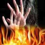 महिला ने पति पर लगाया पेट्रोल डालकर आग लगाने का आरोप, 40 फीसदी से अधिक आग में झुलसी महिला 