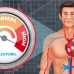शरीर में क्यों बढ़ता है कोलेस्ट्रॉल का लेवल? आइये जानते हैं क्या कहते हैं स्वास्थ्य विशेषज्ञ