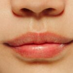 यदि आप भी उन्हीं लोगों में से हैं, जिनके गर्मी में फट रहे होंठ, तो इन चीजों का इस्तेमाल करके इस परेशानी से पाए राहत 